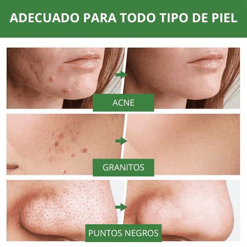 Green Mask Mascarilla de Limpieza Profunda de té Verde - [PROMOCIÓN DISPONIBLE SOLO HOY]