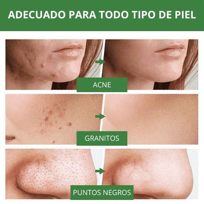 Green Mask Mascarilla de Limpieza Profunda de té Verde - [PROMOCIÓN DISPONIBLE SOLO HOY]
